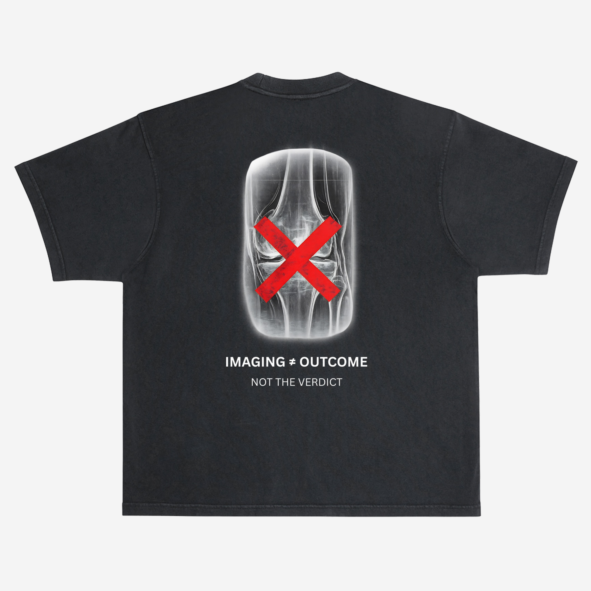 EMPIRIC. IMAGING ≠ OUTCOME tee — back print detail, knee X-ray graphic