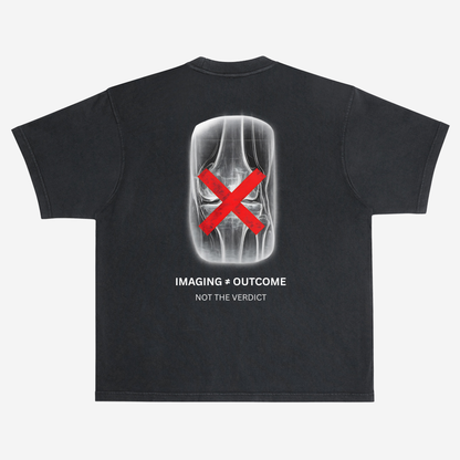 EMPIRIC. IMAGING ≠ OUTCOME tee — back print detail, knee X-ray graphic