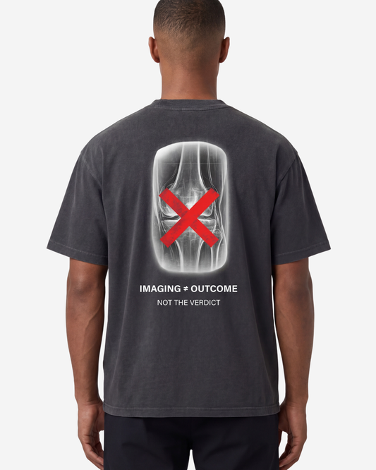 EMPIRIC. IMAGING ≠ OUTCOME tee — front view, black garment-dyed heavyweight cotton